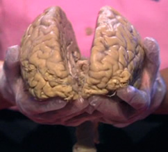 photo of 2 halves of brain open to see in-between in pair of hands
